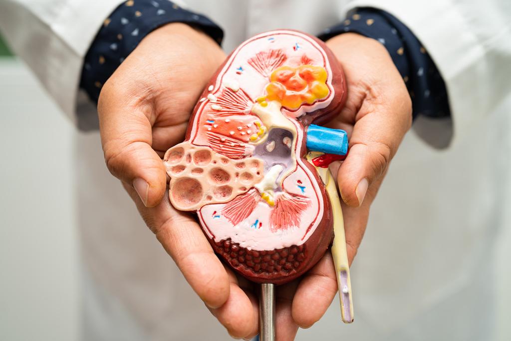 Doctor holds plastic model of kidney in hands.