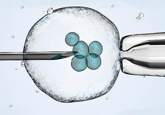 IVF cell injection