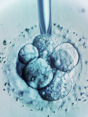 Human Embryo Research Beyond the Primitive Streak