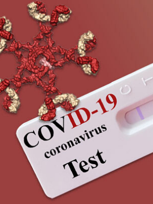 Covid-19 antibody test