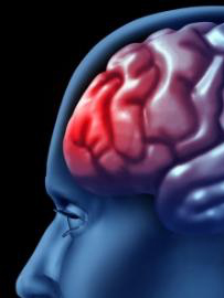 brain injury image